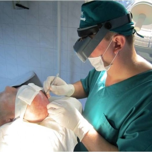 hair implant
